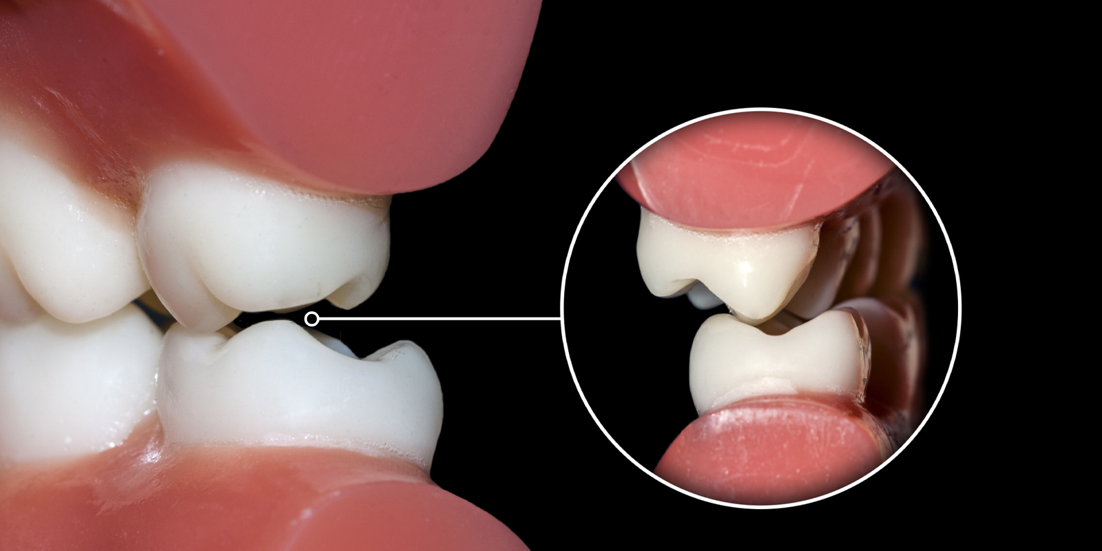 初診時の費用について